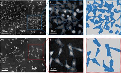 Live-cell analysis framework for quantitative phase imaging with slightly off-axis digital holographic microscopy